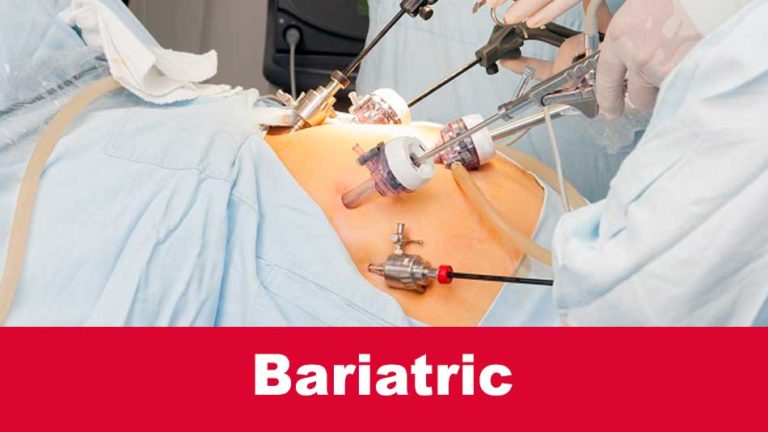 What is bariatric mean