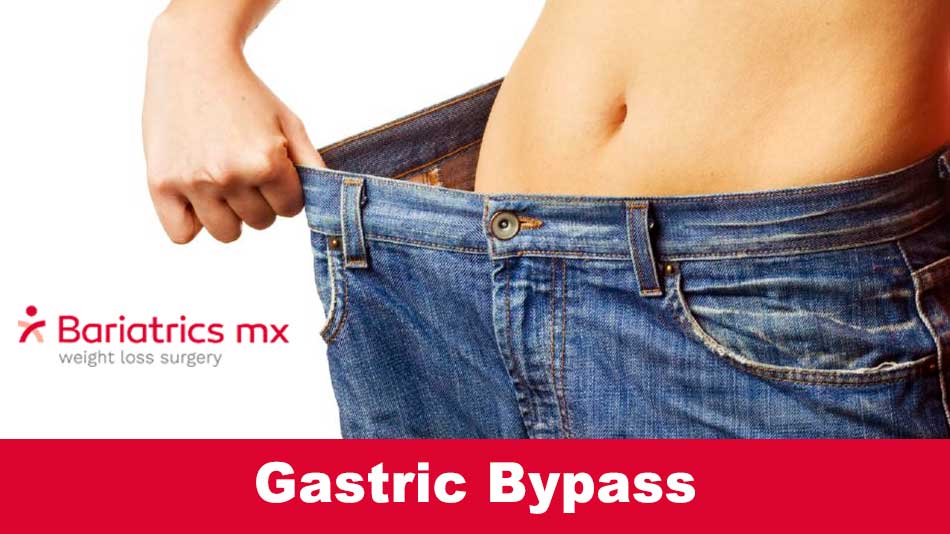 gastric bypass | gastric bypass before and after | gastric bypass cost | gastric bypass before and after pictures skin | gastric bypass diet | how much is gastric bypass | what is gastric bypass | what is gastric bypass surgery | gastric bypass revision | gastric bypass surgery cost | gastric bypass side effects | things you can t do after gastric bypass | gastric bypass surgery before and after | bypass gastrico | gastric bypass requirements | how much does gastric bypass cost | how much is gastric bypass surgery | what is a gastric bypass | gastric bypass before and after pictures | gastric bypass complications | gastric bypass mexico | gastric bypass pre op diet | gastric bypass recovery | gastric bypass recovery time | gastric bypass surgery near me | gastric bypass weight loss | pre gastric bypass diet | types of gastric bypass | gastric bypass price | gastric bypass surgery diet | gastric bypass surgery requirements | how does gastric bypass work | how much does gastric bypass surgery cost | how to restart weight loss after gastric bypass | long term diet after gastric bypass surgery | gastric bypass complications years later | gastric bypass near me | gastric bypass results | gastric bypass vitamins | gastric bypass weight loss chart | is gastric bypass safe | diet after gastric bypass | foods you can t eat after gastric bypass surgery | gastric bypass diet without surgery | gastric bypass meal plan | gastric bypass pros and cons | gastric bypass surgery cost without insurance | gastric sleeve revision to bypass reviews | how long does gastric bypass surgery take | is gastric bypass reversible | gastric bypass cost in mexico | gastric bypass procedure | gastric bypass revision surgery | gastric bypass surgery complications | gastric bypass surgery time | is gastric bypass covered by insurance