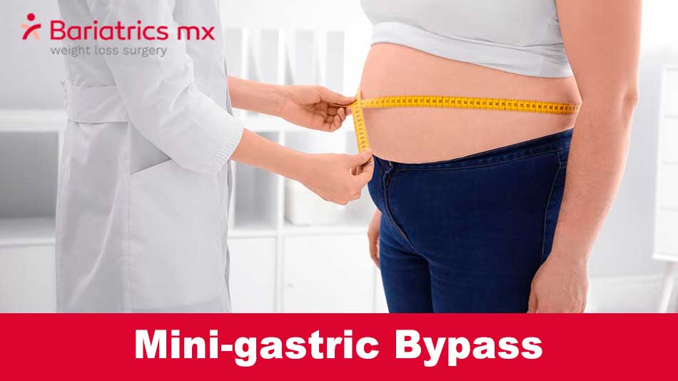 mini gastric bypass cost | what is a mini gastric bypass | mini gastric bypass vs gastric bypass | mini gastric bypass cost | mini bypass gastrico | mini gastric bypass diet reviews | mini gastric bypass forum | mini gastric bypass surgery video | mini loop gastric bypass | how much does a mini gastric bypass cost | mini bypass after gastric sleeve | non surgical mini gastric bypass | mini gastric bypass surgery pros and cons | sleeve revision to mini gastric bypass | mini gastric bypass and acid reflux mini gastric bypass before after | mini gastric bypass before after | mini gastric bypass reflux | mini sleeve gastric bypass surgery | side effects of mini gastric bypass surger | how much does mini gastric bypass surgery cost | mini gastric bypass mexico cost | mini gastric bypass nz | mini gastric bypass procedure | mini gastric bypass results | que es el mini bypass gastrico | cost of mini gastric bypass surgery | is mini gastric bypass reversible | is mini gastric bypass safe | mini gastric bypass animation | mini gastric bypass journey | mini gastric bypass no surgery | mini gastric bypass no surgery formula | mini gastric bypass price | mini gastric bypass side effects | what is mini gastric bypass surgery | bile reflux after mini gastric bypass | complications of mini gastric bypass | diet after mini gastric bypass surgery | difference between mini gastric bypass and gastric bypass | life after mini gastric bypass surgery | mini bypass gastrico que es | mini bypass gastrico video | mini bypass vs gastric bypass | mini gastric bypass before and after | mini gastric bypass complications | mini gastric bypass definition | mini gastric bypass diet | mini gastric bypass in tijuana | mini gastric bypass mexico | mini gastric bypass near me | mini gastric bypass post op diet | mini gastric bypass procedure steps | mini gastric bypass pros and cons | mini gastric bypass recovery time | mini gastric bypass reviews | mini gastric bypass revision | mini gastric bypass risks