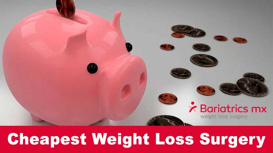 cheapest weight loss surgery | low cost bariatric surgery | low cost bariatric surgery near me | cheapest surgery for weight loss | cheapest weight loss surgery abroad | what is the cheapest weight loss surgery | what's the cheapest weight loss surgery | cheapest and easiest form of weight loss surgery | cheapest place in va to have weight loss surgery | cheapest place to get weight loss surgery | cheapest way to finance weight loss surgery | cheapest way to get weight loss surgery | cheapest weight loss surgeries