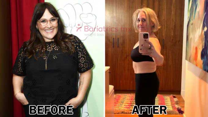 Ricki Lake weight loss / Before and After