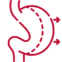 Mini Gastric Sleeve Mexico